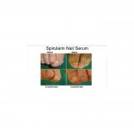 SPIRULARIN® ANTIFUNGÁLNÍ SÉRUM NA NEHTY, 10 ML 5